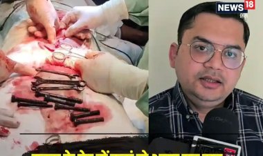 बेटे को अस्पताल ले गया पिता, बोला- इसका पेट..., चेक करते ही डॉक्टर्स की फटी रह गईं आंखें