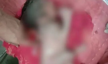 गर्भ से बच्चे को निकलते देख मां की चीख निकली, तीसरा हाथ पीठ पर बड़ा हो गया था, तीन अंगुलियां.,