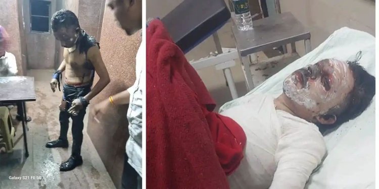 चौंकाने वाला अपराध: ठक्कर बाजार बस स्टैंड के शौचालय में 'हैप्पी होली' कहते हुए पेट्रोल डालकर जलाए गए कर्मचारी की मौत